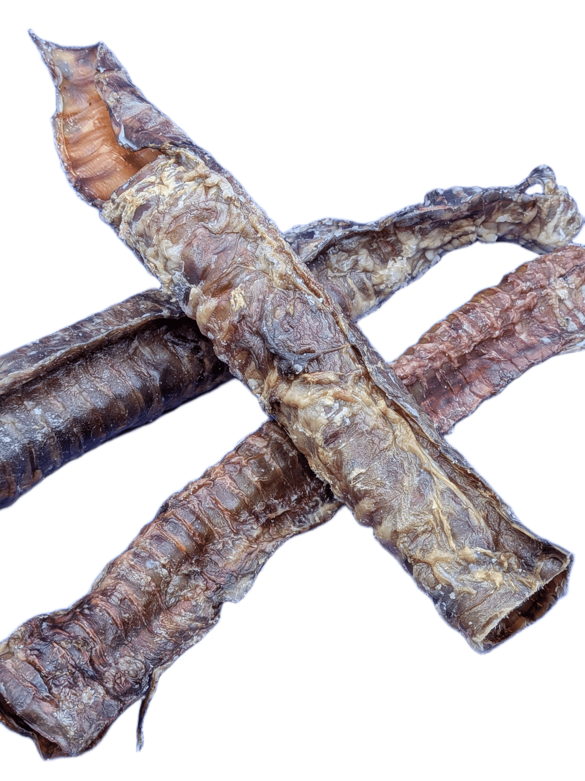 Trachea